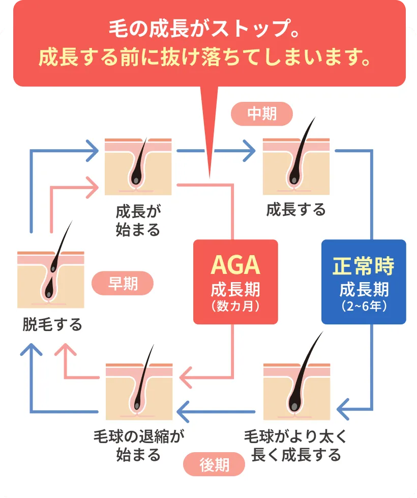 毛の成長がストップ。成長する前に抜け落ちてしまいます。