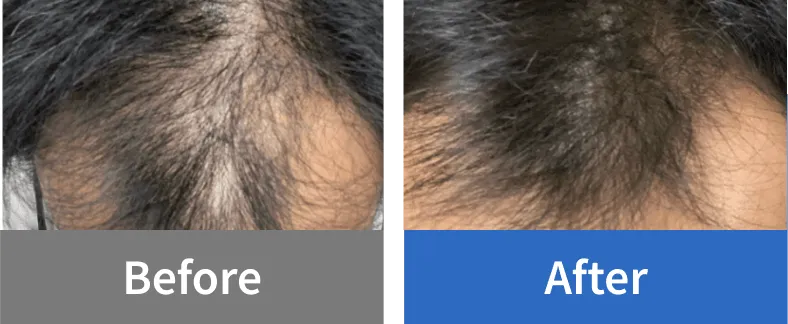 Before After