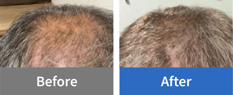 Before After