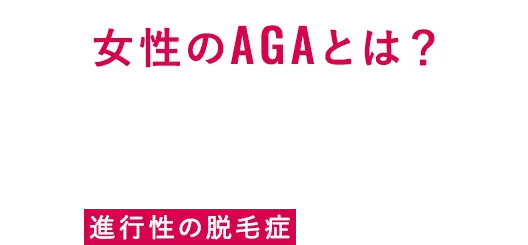女性のAGAとは？