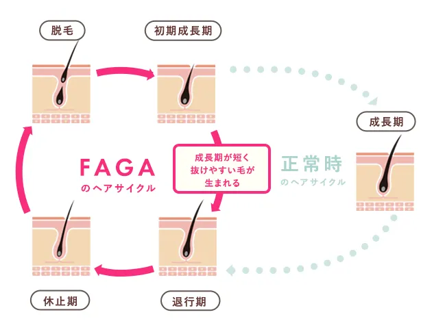 ヘアサイクル