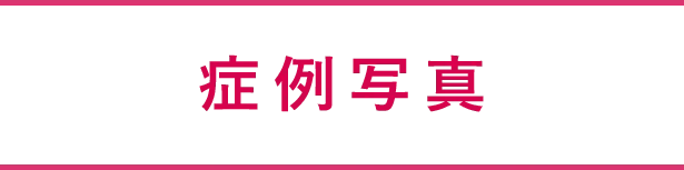 症例写真