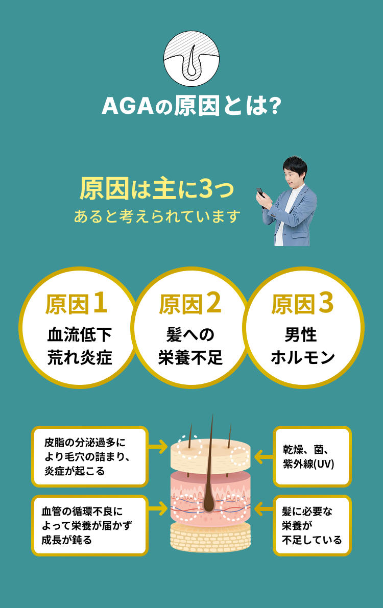 AGAの原因とは？原因は主に3つ 原因1 血流低下・荒れ炎症 原因2 髪への栄養不足 原因3 男性ホルモン