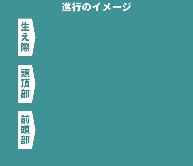毛髪数の変化 進行のイメージ