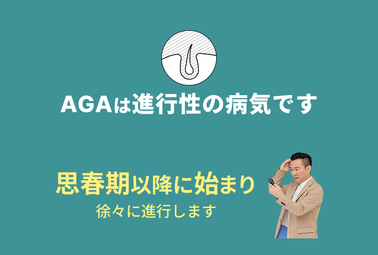 AGAは進行性の病気です