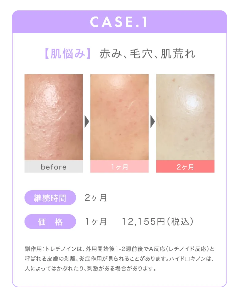 CASE1