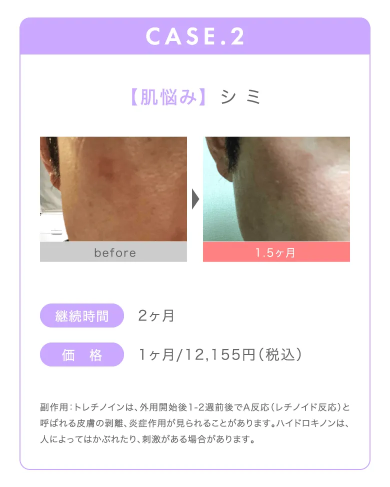CASE2