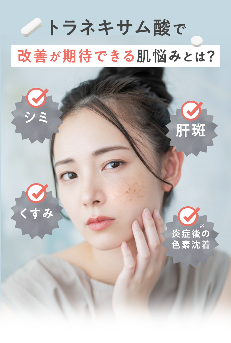 トラネキサム酸で改善が期待できる肌悩みとは？