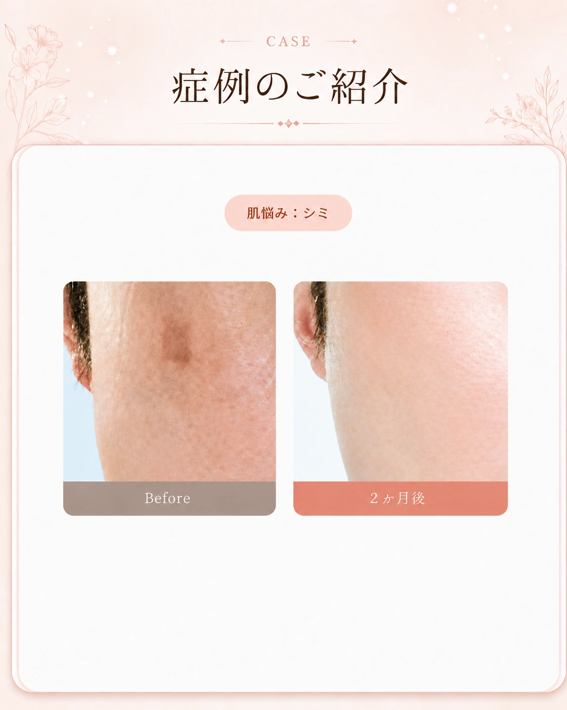 症例のご紹介