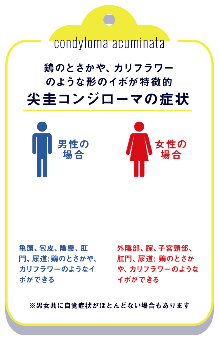尖圭コンジローマの症状