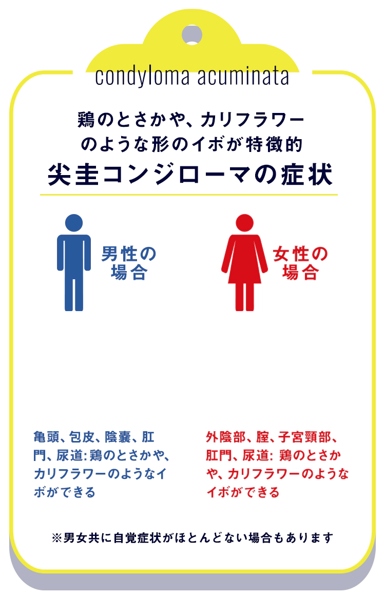 尖圭コンジローマの症状