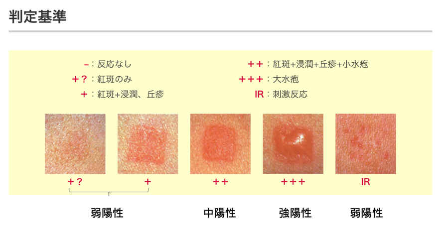 金属アレルギー 判定基準