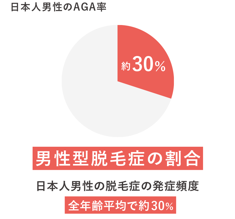 日本人男性のAGA率