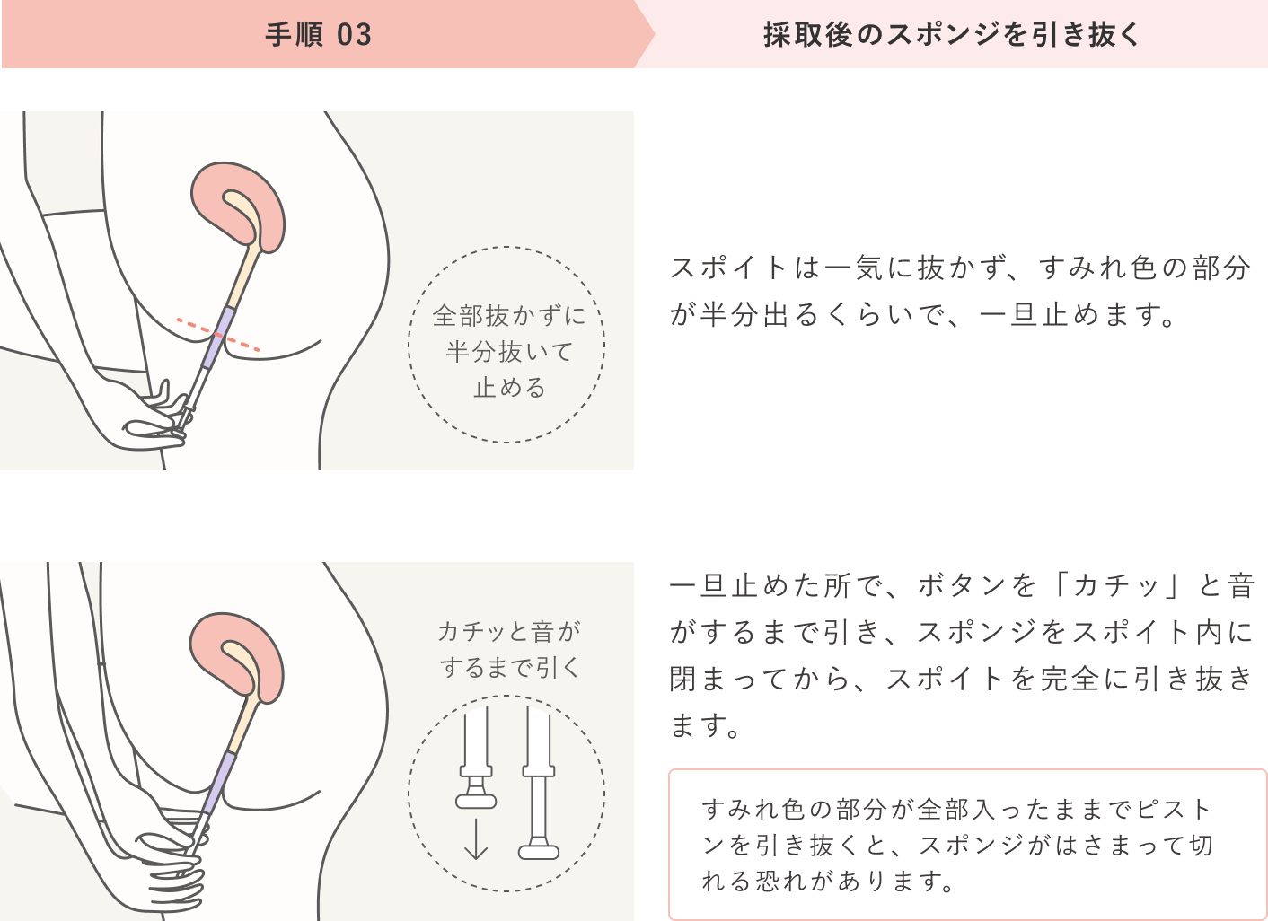 手順03 採取後のスポンジを引き抜く