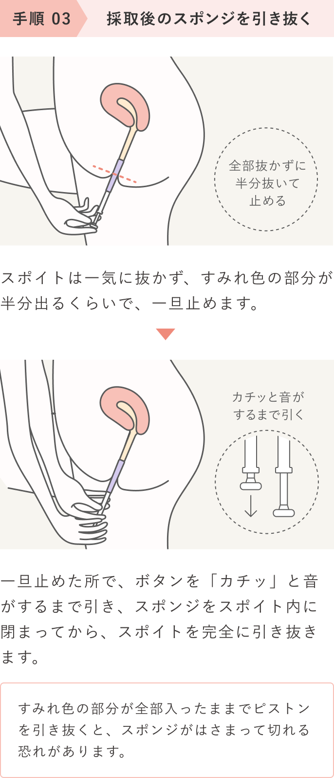 手順03 採取後のスポンジを引き抜く