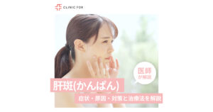 肝斑 (かんぱん)の症状・原因・対策と治療法について、医師が解説します。
