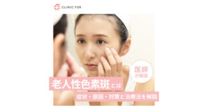 老人性色素斑の症状・原因・対策と治療法について、医師が解説します。