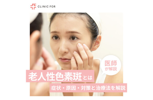 老人性色素斑の症状・原因・対策と治療法について、医師が解説します。