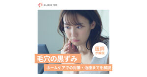 毛穴の気になる黒ずみ。ホームケアでの対策・治療まで医師が解説します。