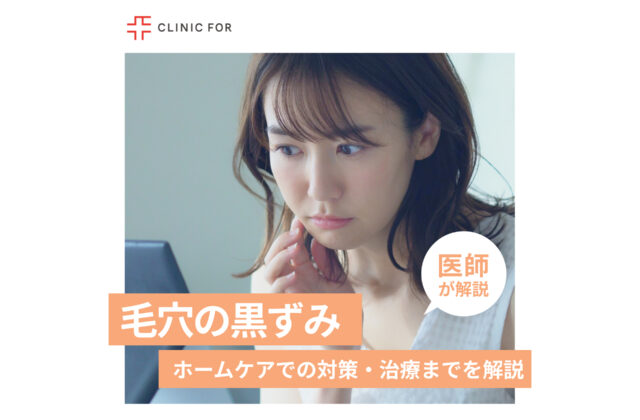 毛穴の気になる黒ずみ。ホームケアでの対策・治療まで医師が解説します。
