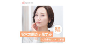 毛穴の開きや黒ずみにお悩みの方へ。治療法について医師が解説します。