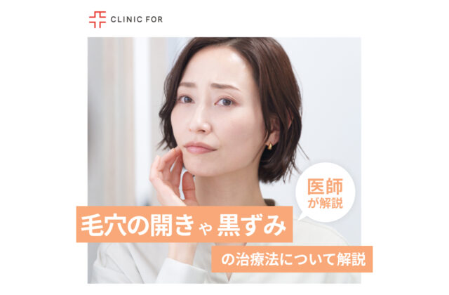 毛穴の開きや黒ずみにお悩みの方へ。治療法について医師が解説します。