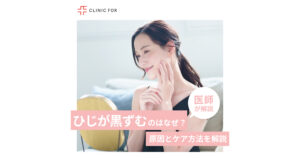 ひじが黒ずむのは何故?原因とケア方法を医師が解説します。