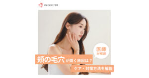 頬の毛穴が開く原因は?ケア・対策方法を医師が解説します