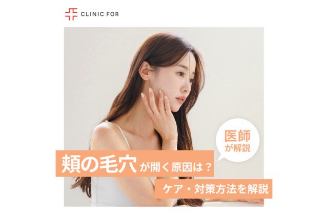 頬の毛穴が開く原因は？ケア・対策方法を医師が解説します