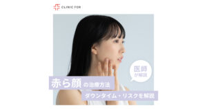 【赤ら顔の治療方法】ダウンタイム・リスクは？セルフケア方法も解説！