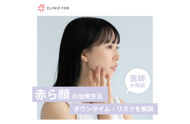 【赤ら顔の治療方法】ダウンタイム・リスクは？セルフケア方法も解説！