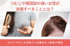つむじや頭頂部の薄い女性が改善すべきこととは?医師が解説します
