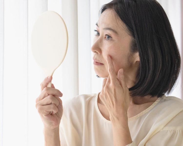 肝斑（かんぱん）