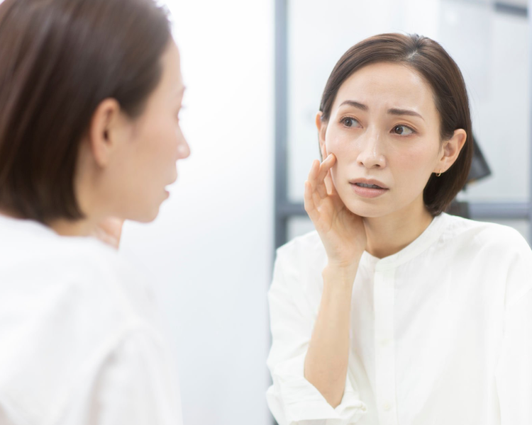 しみ・そばかす