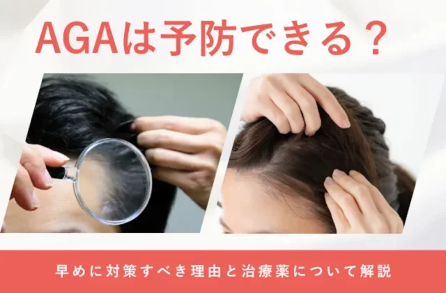 AGAの予防方法や薄毛対策のポイントを解説する画像