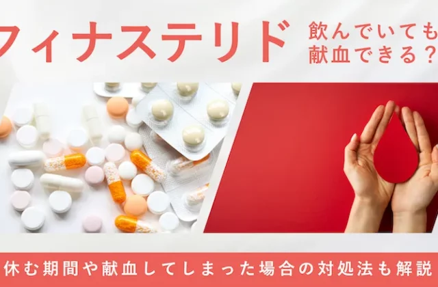 フィナステリド服用中の献血可否や注意点を解説する画像