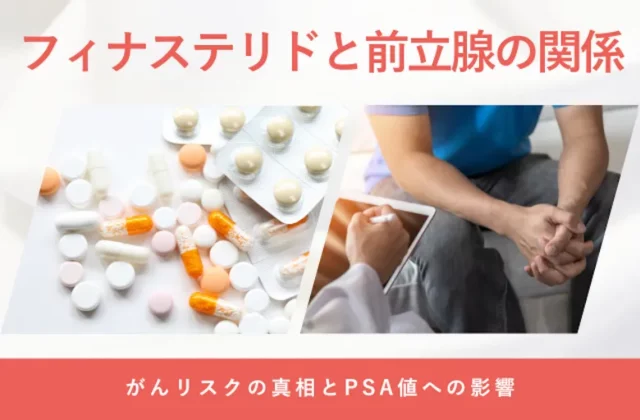 フィナステリドと前立腺への影響やPSA検査の注意点を解説する画像
