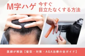 M字ハゲを目立たなくする髪型やセット方法を解説する画像