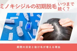 ミノキシジルによる初期脱毛の原因や期間の目安を解説する画像