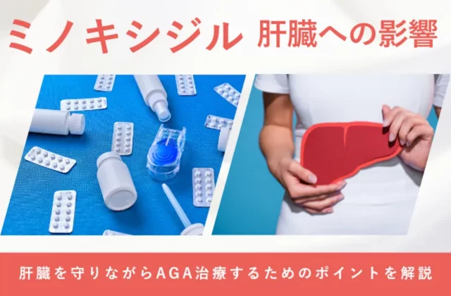 ミノキシジルと肝臓への影響や副作用の注意点を解説する画像
