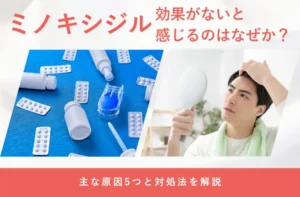 ミノキシジルの効果がないと感じる原因や対処法を解説する画像
