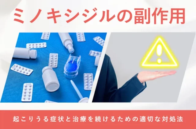 ミノキシジルの副作用や使用時の注意点を解説する画像