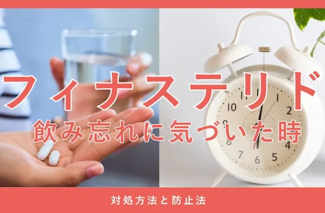 フィナステリドを飲み忘れた場合の対処法や注意点を解説する画像