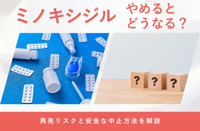 ミノキシジルをやめるとどうなるのかや中止後の変化を解説する画像