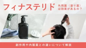 フィナステリド外用薬の特徴や効果について解説する画像
