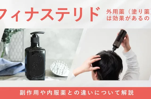 フィナステリド外用薬の特徴や効果について解説する画像